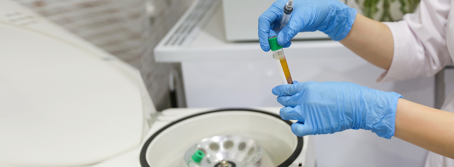 The image shows a person wearing gloves holding a small object above a white surface with a blue background, possibly indicating a scientific or medical setting.