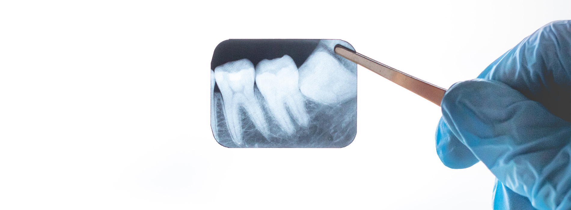 The image shows a dental hygiene scene with a person wearing gloves holding a toothbrush near an X-ray, which appears to be of a human mouth.
